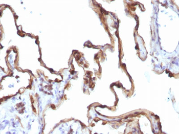 Cytokeratin 7 (KRT7) (Glandular and Transitional Epithelial Marker) Antibody - With BSA and Azide
