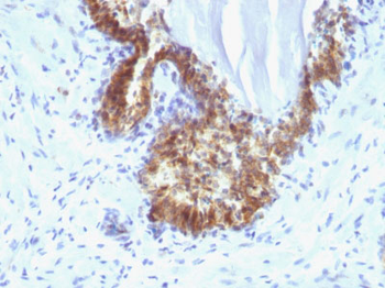 Prostate Specific Antigen (PSA) Antibody - With BSA and Azide