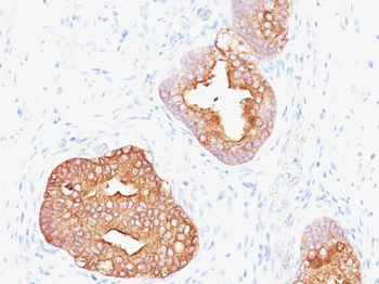 Prostate Specific Antigen (PSA) Antibody - With BSA and Azide