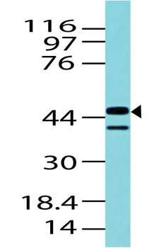 IDH1 (Isocitrate Dehydrogenase) Antibody - With BSA and Azide