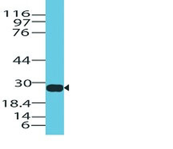 Granzyme B (NK/T-Cell Lymphoma Marker) Antibody - With BSA and Azide
