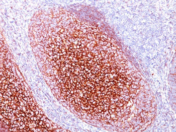 CD35 / CR1 (Follicular Dendritic Cell Marker) Antibody - With BSA and Azide