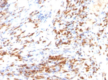 p27Kip1 (Mitotic Inhibitor/Suppressor Protein) Antibody - With BSA and Azide