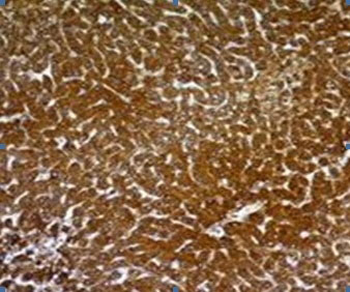 Hepatocyte Specific Antigen (Hepatocellular Marker) Antibody - With BSA and Azide