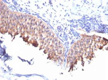 Cytokeratin 10 (KRT10) (Suprabasal Epithelial Marker) Antibody - With BSA and Azide