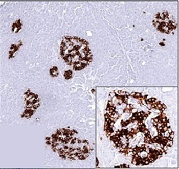 Insulin / IRDN (beta-Cell & Insulinoma Marker) Antibody - With BSA and Azide