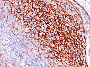CD35 / CR1 (Follicular Dendritic Cell Marker) Antibody - With BSA and Azide