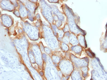 HCG-beta (Pregnancy & Choriocarcinoma Marker) Antibody - With BSA and Azide
