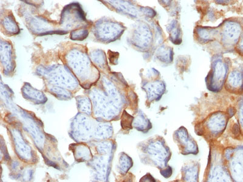 HCG-beta (Pregnancy & Choriocarcinoma Marker) Antibody - With BSA and Azide