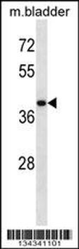 USP12 Antibody (Center)