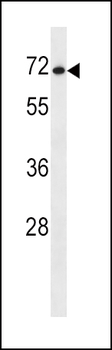 SLC7A1 Antibody (C-term)