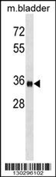 ISL1 Antibody (Center)
