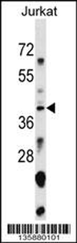SNAPC1 Antibody (Center)