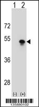 SNAPC1 Antibody (Center)