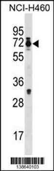Mouse Csrnp2 Antibody (N-term)