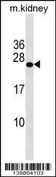 GRPEL2 Antibody (N-term)