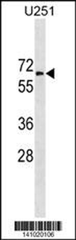 GGT1 Antibody (N-term)
