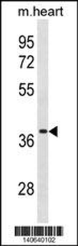 VSIG2 Antibody (C-term)