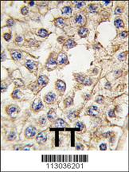 EPHA10 Antibody (Center)