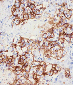 PD L1 Monoclonal Antibody (PDL1)