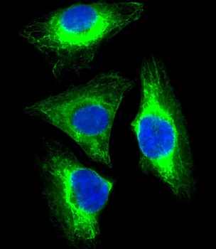 CYK18 Antibody (C-term)