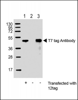 T7 tag