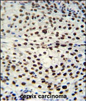 HNRPAB Antibody (N-term)