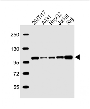 SLC22A2 Antibody (N-term)