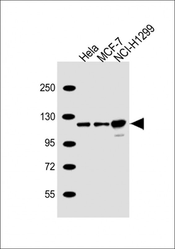 PPP1R13L Antibody (N-Term)