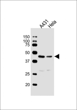 LEFTY2 Antibody
