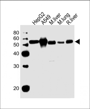 ALDH2 Antibody (N-term)