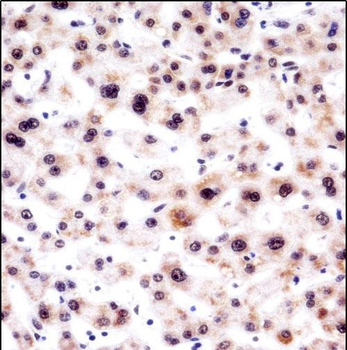 SNRPA Antibody (Center)