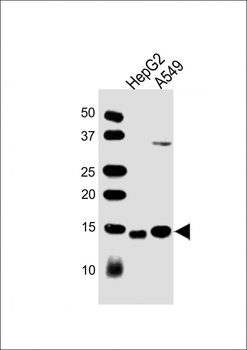 COX5B Antibody (Center)