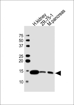 ATP6V1G1 Antibody(C-term)