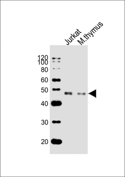 (Mouse) Dpf2 Antibody (N-term)