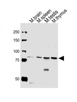 (Mouse) Med15 Antibody (C-term)