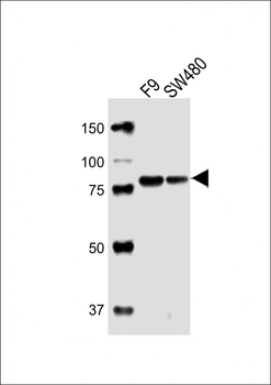 (Mouse) Suz12 Antibody (Center)