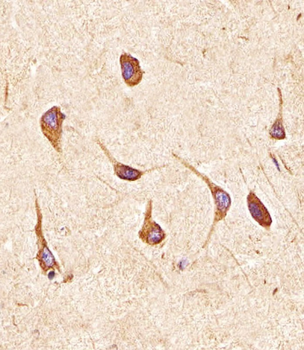 FGFR2 Antibody (N-term)