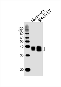 (Mouse) Msi1 Antibody (Center)
