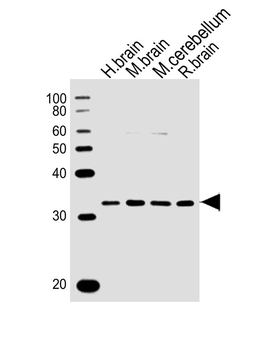 PCGF1 Antibody (Center)