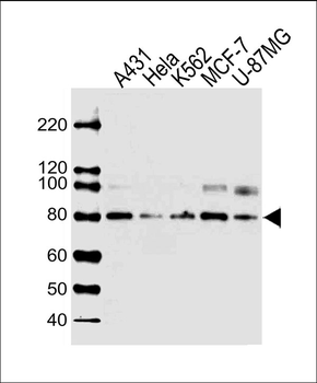 PLOD1 Antibody (N-term)