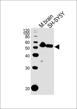 DAPK2 Antibody (N-term)