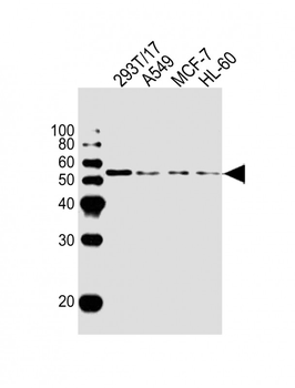 DKK3 Antibody (N-term)
