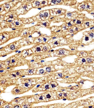 STRADA Antibody (C-term)