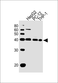 MAPK13/14 Antibody (Center)