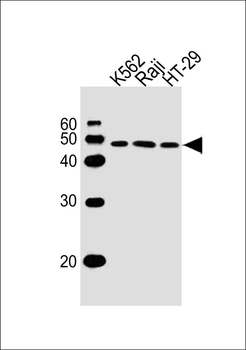 IL13RA1 Antibody (C-term)