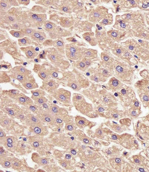 LYN Antibody (Center)
