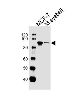 COL9A1 Antibody (Center)