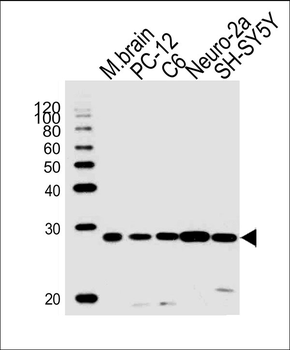 UCHL1 Antibody (C-term)