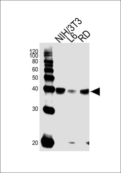 Aldolase (ALDOA) Antibody (N-term)